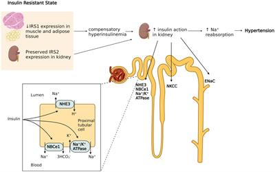 Salt-Sensitivity of Blood Pressure and Insulin Resistance